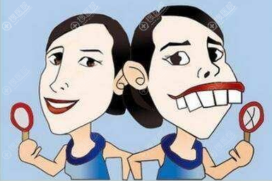 骨性龅牙做正颌手术改善效果 骨性龅牙做正颌手术改善效果