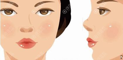 鼻子萎缩是什么引起的 鼻子萎缩是什么引起的