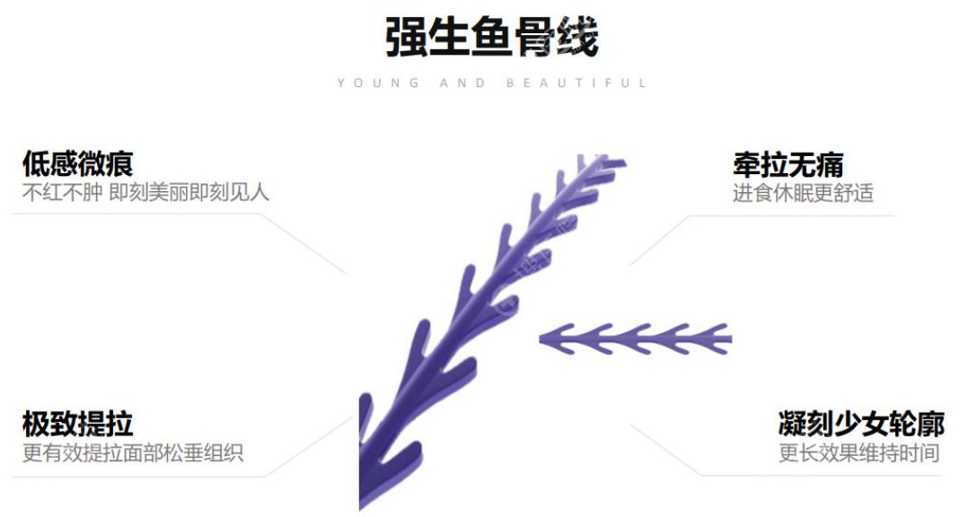 强生鱼骨线优势 强生鱼骨线优势
