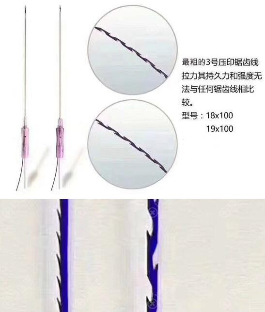 压印锯齿线优势 压印锯齿线优势