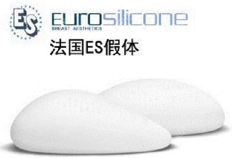 法国ES假体好不好 法国ES假体好不好