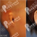 韩国profile讲小耳症用肋软骨人工骨哪种好及耳畸形整形多少钱