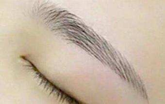 眉毛种植后多长时间毛囊就成活