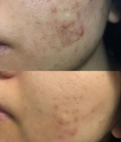 多吃什么会美白