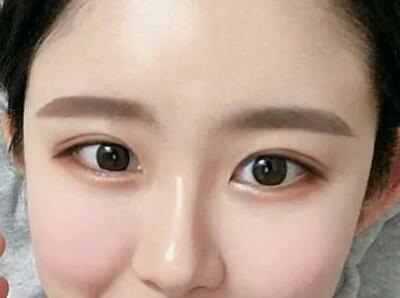 超声祛眼袋并发症有哪些