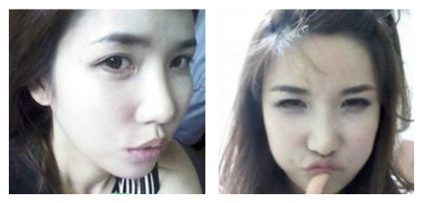 颧骨、下巴和额头都做了,终于敢尽情地自拍了!