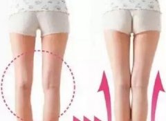 O型腿怎么办?O型腿矫正效