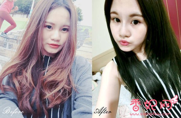 【玻尿酸山根+下巴】微整,鼻+下巴通通挺身而出了香妃网