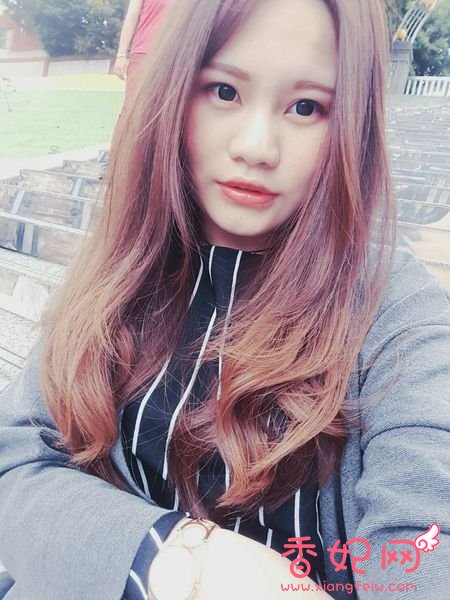 【玻尿酸山根+下巴】微整形案例,鼻+下巴通通挺身而出了