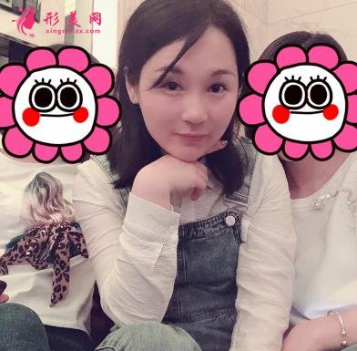 四川华西医院整形科玻尿酸丰太阳穴案例查询!含2022全新价格表公 四川华西医院整形科玻尿酸丰太阳穴案例查询!含2022全新价格表公