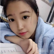 上海九院下颌角手术多少钱?下颌角整形价格+案例分享~