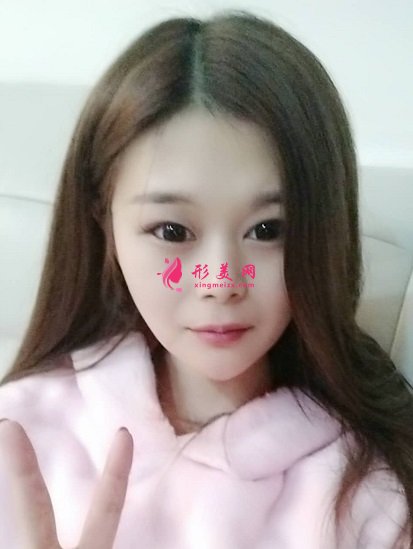 谁让穆宝安做过面部拉皮提升的?分享下北京加减美手术案例及价目表2021