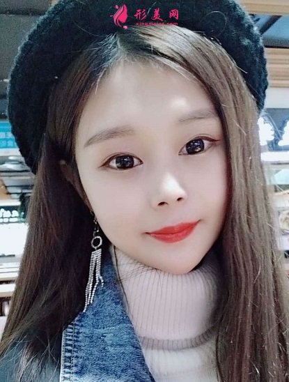 谁让穆宝安做过面部拉皮提升的?分享下北京加减美手术案例及价目表2021