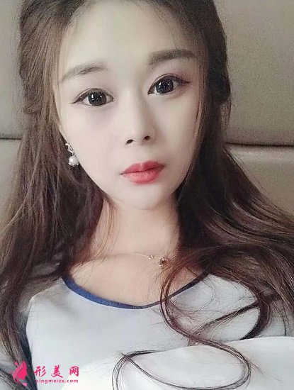 谁让穆宝安做过面部拉皮提升的?分享下北京加减美手术案例及价目表2021