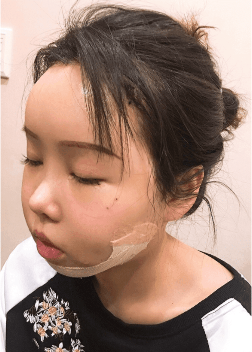 北京八大处磨骨多少钱?2022价格表曝光+磨骨案例 北京八大处磨骨多少钱?2022价格表曝光+磨骨案例