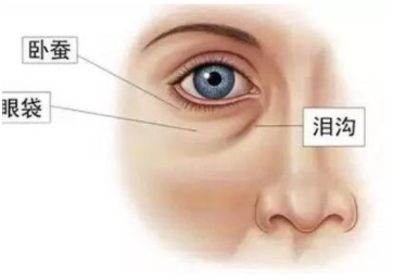怎样彻底去除眼袋?详细讲解眼袋形成的原因及如何去除