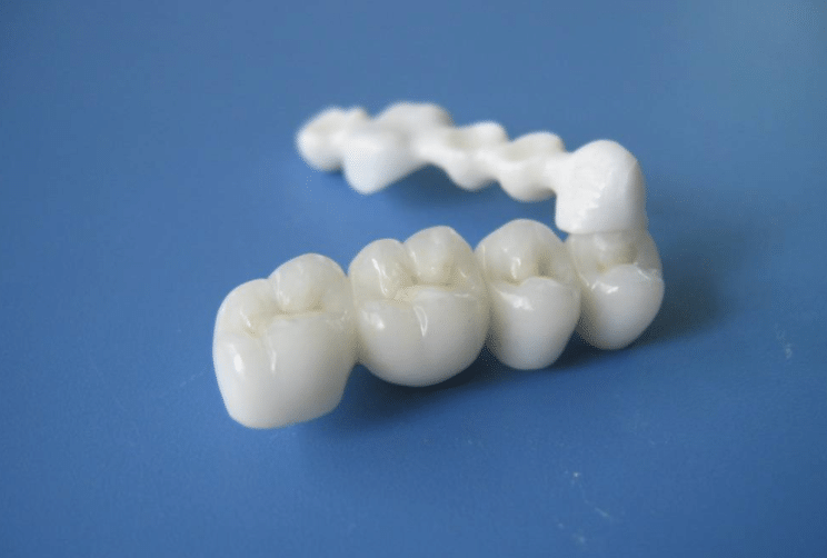 烤瓷牙怎么样?好不好?