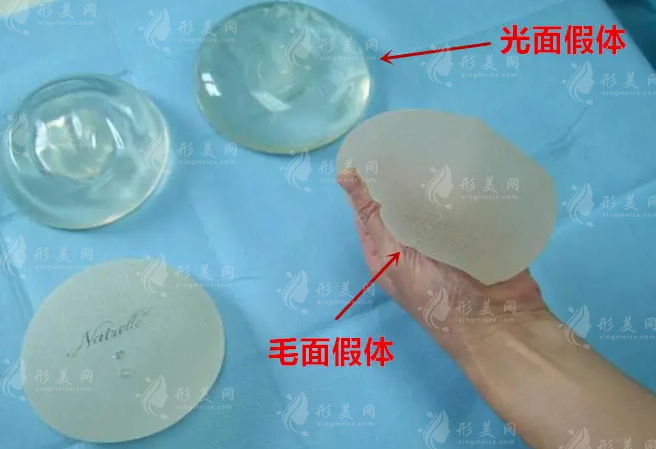 内窥镜丰胸手术恢复期长不长? 内窥镜丰胸手术恢复期长不长?