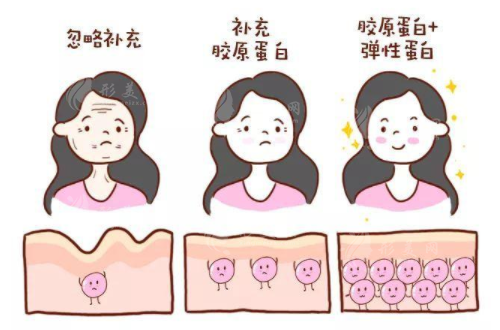 胶原蛋白怎么补?外涂、注射、口服?哪种方式最有用?