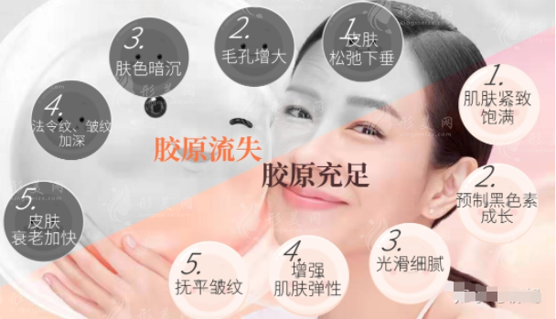 胶原蛋白怎么补?外涂、注射、口服?哪种方式最有用? 胶原蛋白怎么补?外涂、注射、口服?哪种方式最有用?