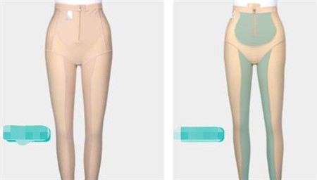 水动力吸脂要多久才能上班,恢复期有哪些注意事项