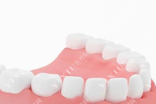 整齐下牙模型示意图 整齐下牙模型示意图