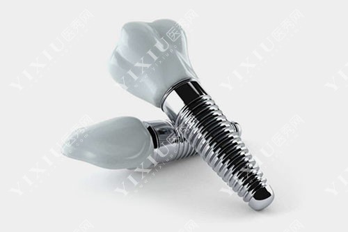 不同牙冠种植牙模型示意图 不同牙冠种植牙模型示意图