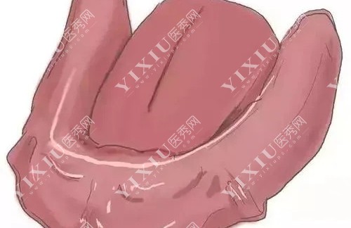 无牙展示图 无牙展示图