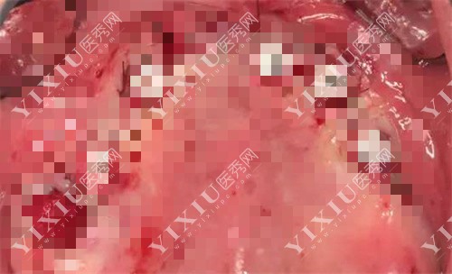 口腔内部展示图 口腔内部展示图