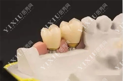 单颗牙齿展示图 单颗牙齿展示图