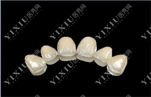 全瓷牙单颗展示图 全瓷牙单颗展示图