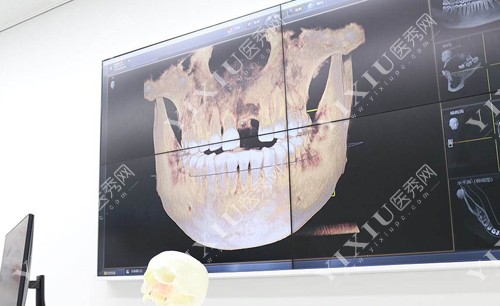 牙缺失口腔医院检查图 牙缺失口腔医院检查图