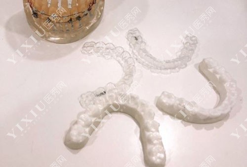 口腔医院隐形牙套介绍 口腔医院隐形牙套介绍