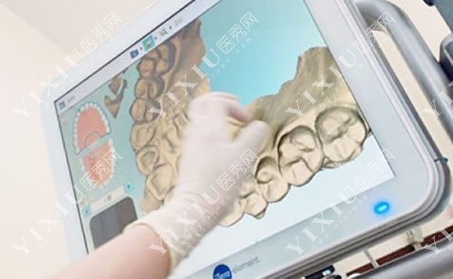 牙齿矫正口扫数据获取 牙齿矫正口扫数据获取