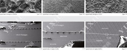 西泰克种植体材质优势 西泰克种植体材质优势