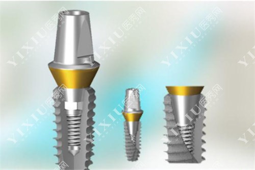 种植牙实体图 种植牙实体图