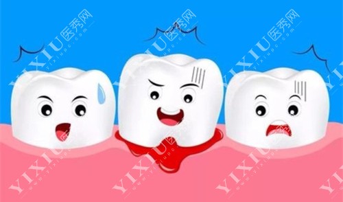 卡通牙齿红肿图 卡通牙齿红肿图