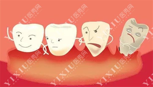 牙齿卡通图 牙齿卡通图