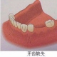 咸阳海涛口腔医院种植牙案例分享_咸阳海涛口腔医院整形案例
