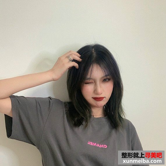 切开双眼皮和开内眼角效果格外自然 切开双眼皮和开内眼角效果格外自然