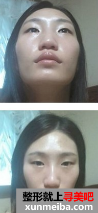 磨颧骨 实现美的自己让男朋友越来越爱 - 寻美吧