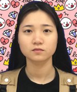 来看看我埋线20天的果恢复图！内有手术之前的样子哦