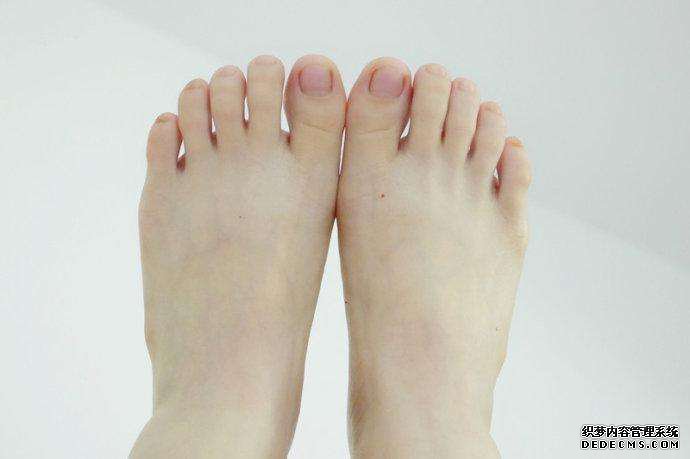 大脚骨症状