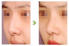 东方和谐能做鼻子矫正手术吗