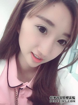 潍坊华美童艳梅医生做的面部脂肪填充,大家来看看效果怎么样