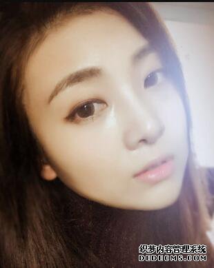 鼻子整形过程恢复图片,真实案例分享