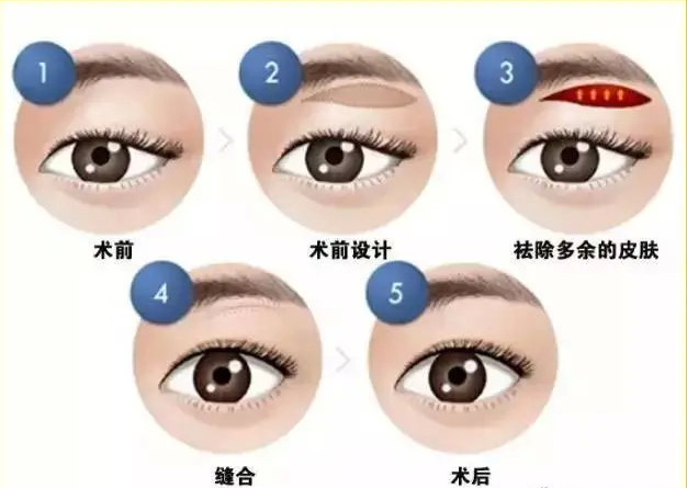 切眉or提眉哪个效果更好?