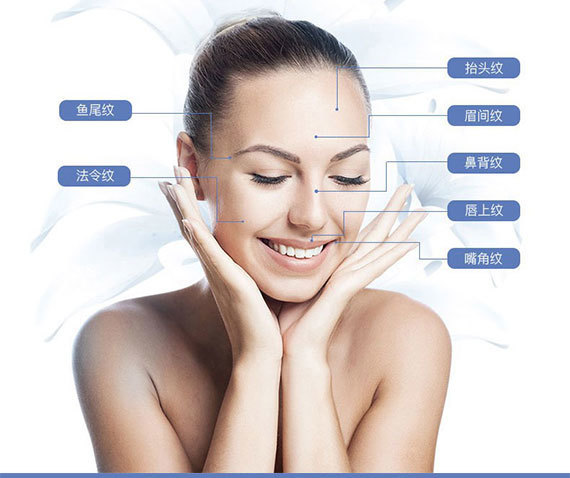 botox去鱼尾纹多少钱 botox去鱼尾纹多少钱