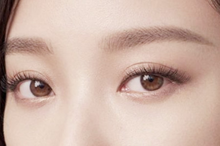 埋线双眼皮适合在哪里做 埋线双眼皮适合在哪里做