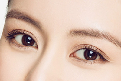 埋线双眼皮适合在哪里做 埋线双眼皮适合在哪里做